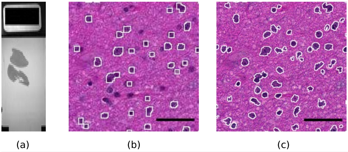 Fig1 Deroulers DiagnosticPath2013 8.jpg