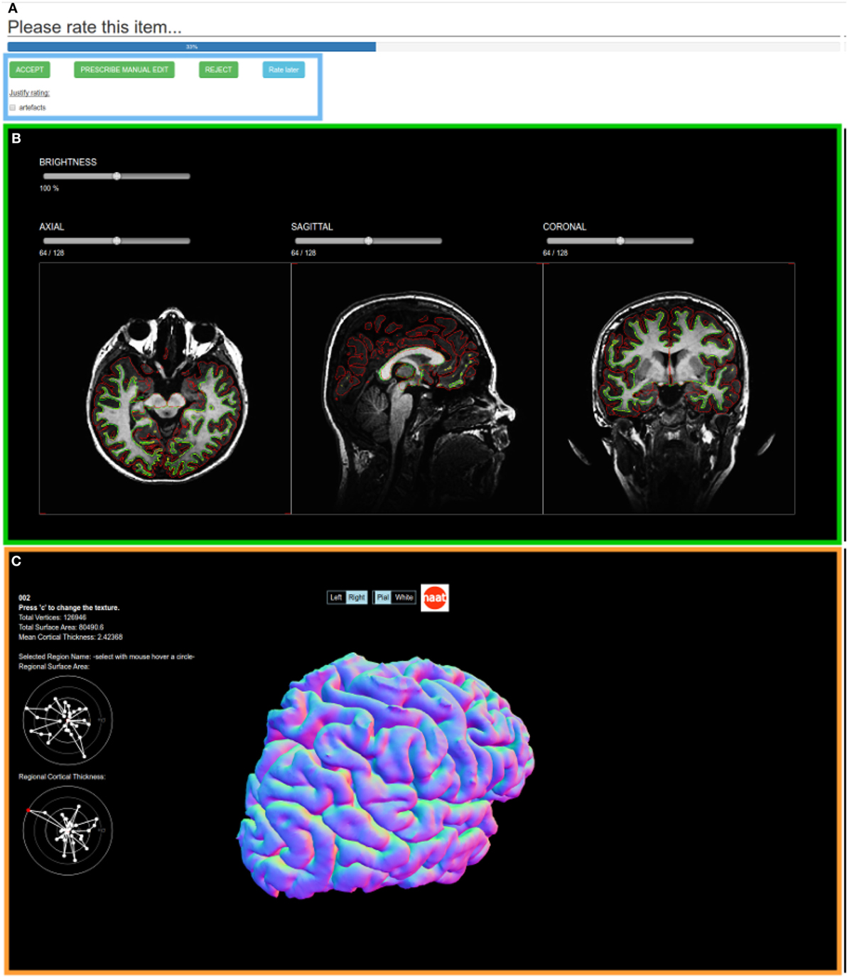 Fig3 Grigis FInNeuroinformatics2017 11.jpg