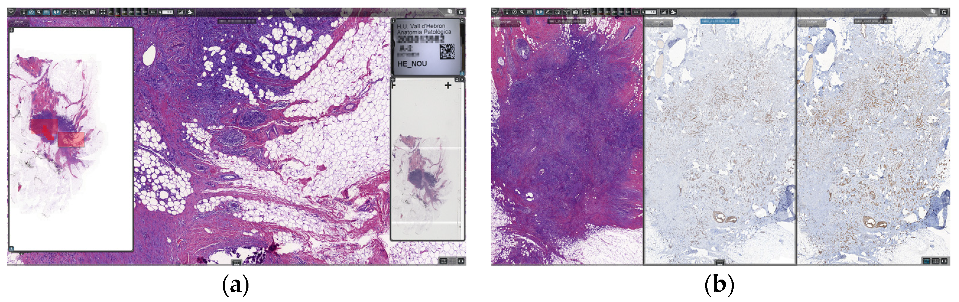 Fig7 Temprana-Salvado Diagnostics22 12-4.png